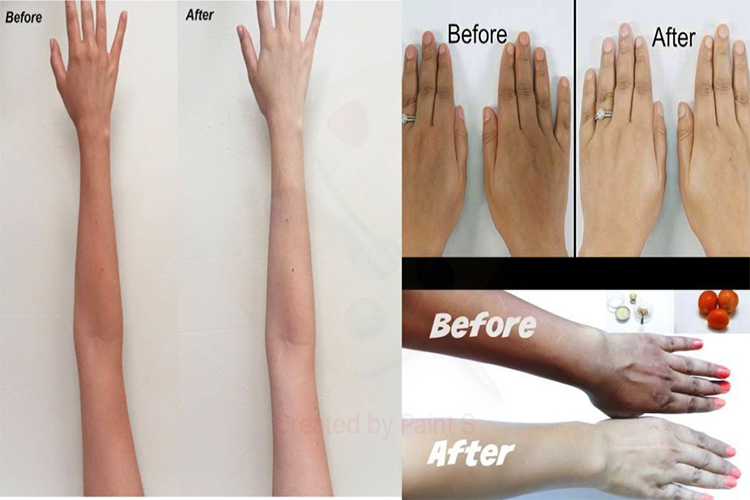 How to remove tan from hands